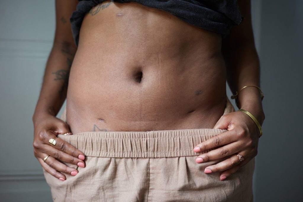 A close-up of a woman's torso with her grey shirt rolled up, the top of her beige pants rolled down, and her hands on her waistband at her hips.